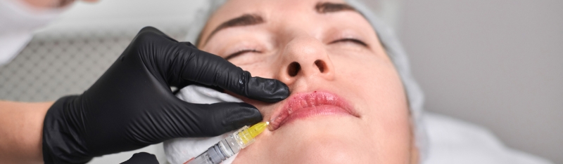 Lip fillers treatment in London performed with a natural medical led approach