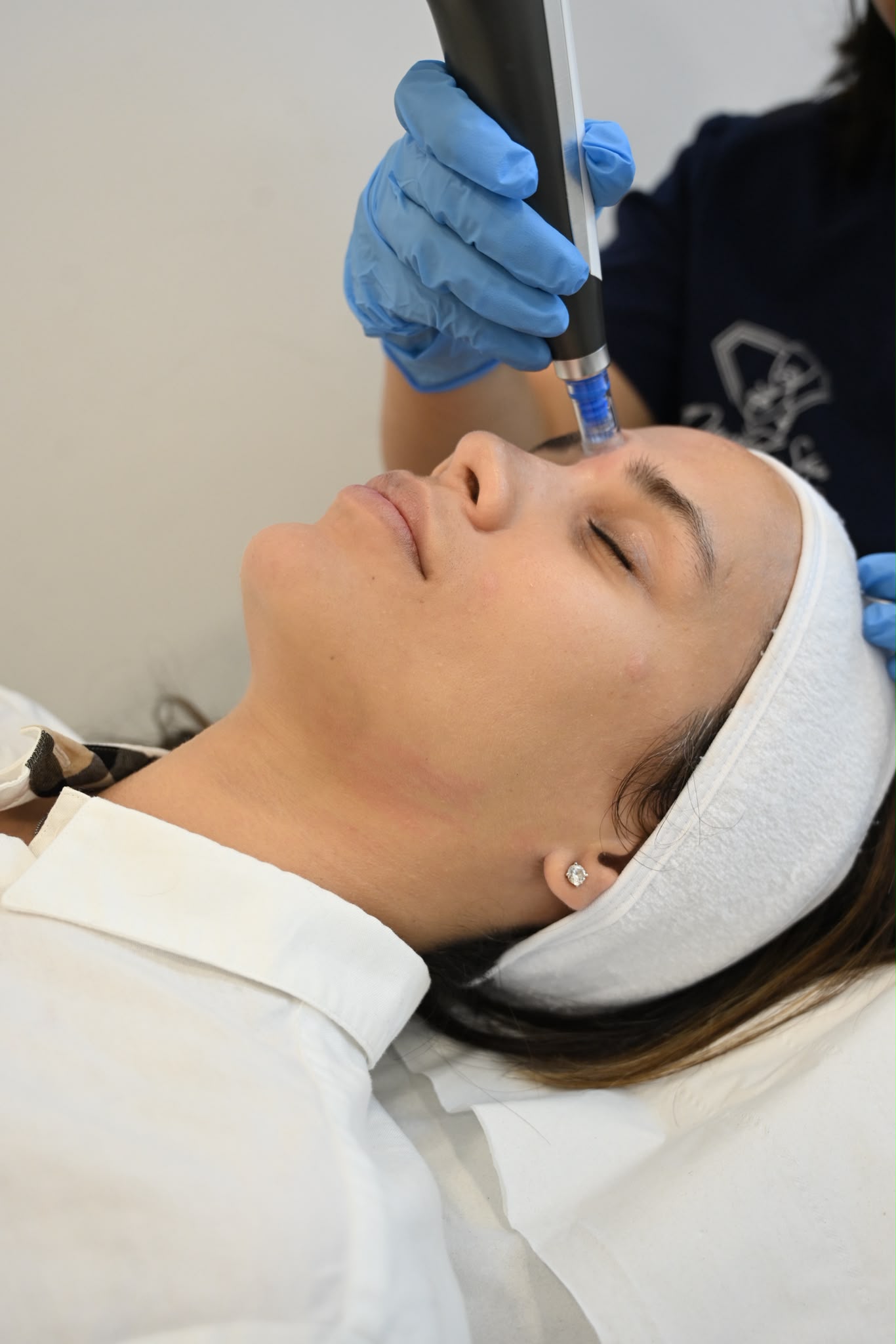 Microneedling Face Session