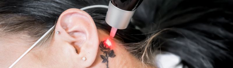 Leave the Past Behind: Transform Your Tattoo Regrets into a Masterpiece